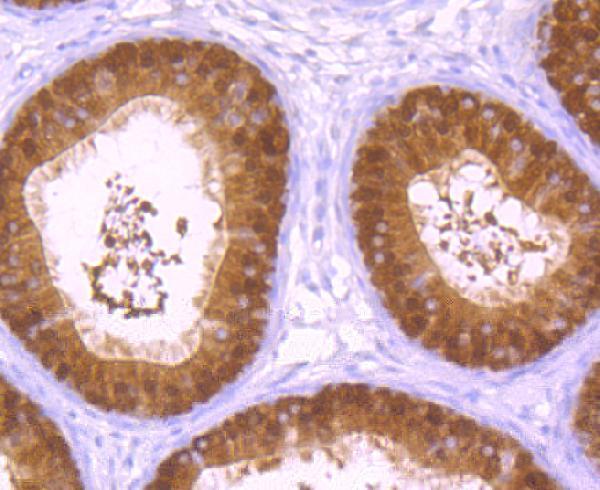 a02900 2 xpo5 primary antiboties ihc testing 2