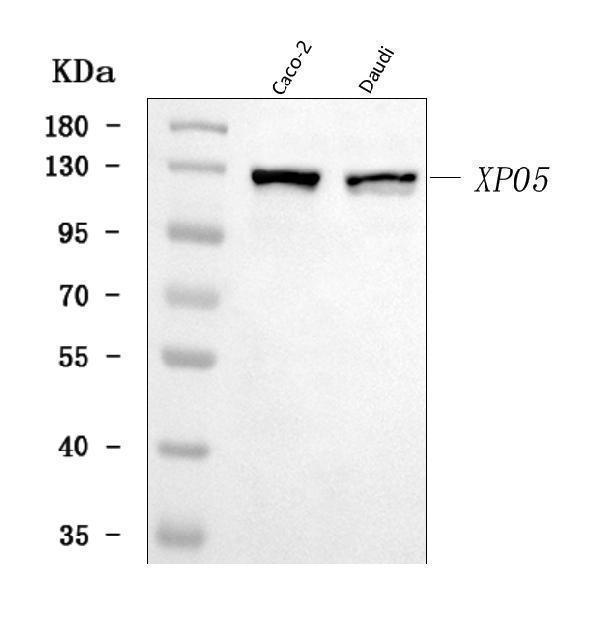  Western blot analysis of Exportin-5/XPO5 using anti-Exportin-5/XPO5 antibody (A02900-3)
