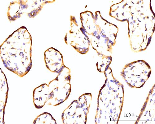  IHC analysis of RPL11 using anti-RPL11 antibody (A02901-1)