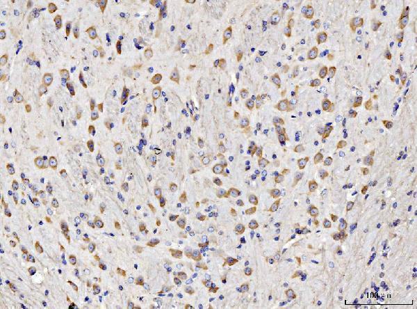 IHC analysis of RPL11 using anti-RPL11 antibody (A02901-1)