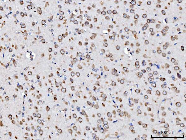 a02901 1 rpl11 primary antibodies ihc testing 4