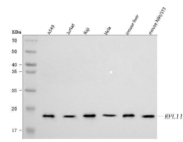  Western blot analysis of RPL11 using anti-RPL11 antibody (A02901-1)