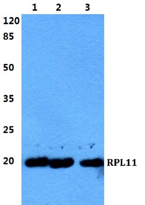 Western blot (WB) analysis of RPL11 polyclonal antibody at 1:500 dilution
Lane1:MCF-7 cell lysate
Lane2:sp2/0 cell lysate
Lane3:H9C2 cell lysate
