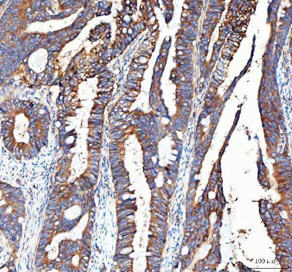  IHC analysis of Integrin alpha 3/ITGA3 using anti-Integrin alpha 3/ITGA3 antibody (A02902-1)