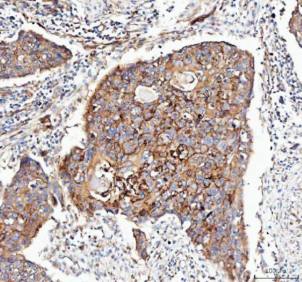  IHC analysis of Integrin alpha 3/ITGA3 using anti-Integrin alpha 3/ITGA3 antibody (A02902-1)
