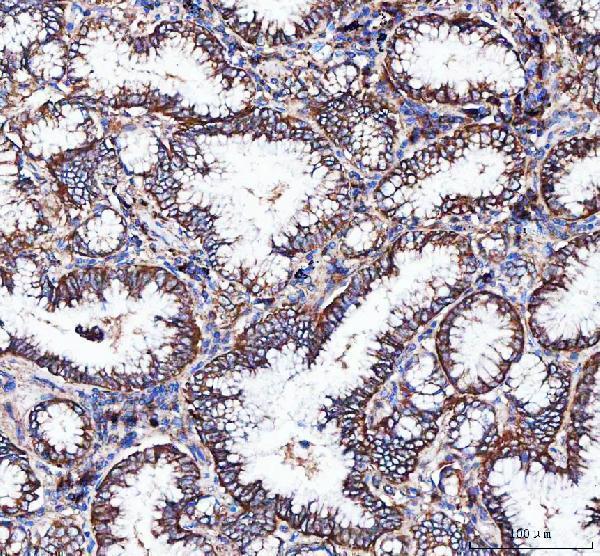 a02902 1 itga3 primary antibodies ihc testing 4