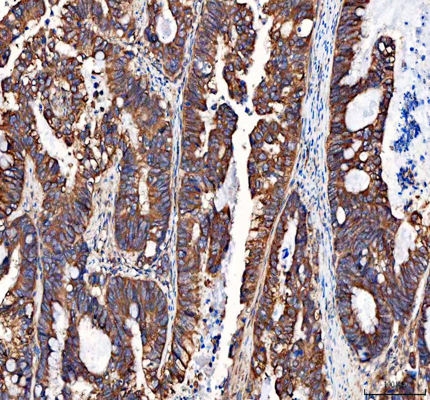 a02902 integrin alpha 3 primary antibodies ihc testing 1