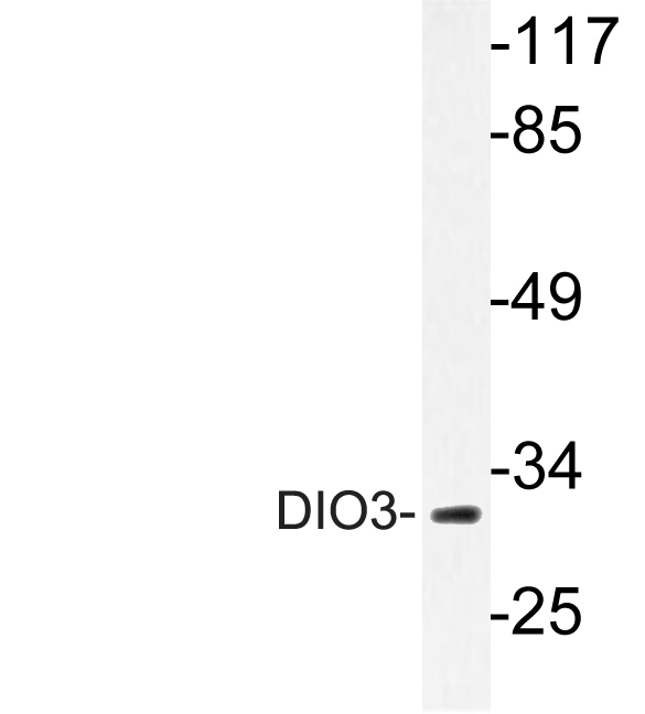 Western blot analysis of lysate from HUVEC cells, using DIO3 antibody