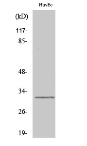 Western Blot analysis of various cells using DIO3 Polyclonal Antibody