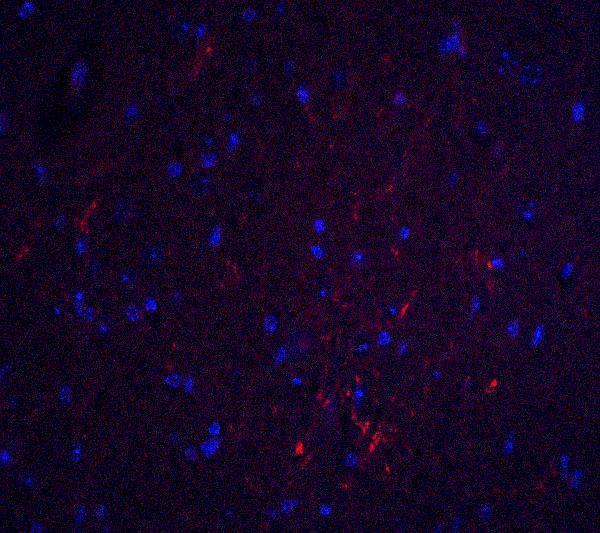 a02904 s1pr2 primary antibodies if testing 3