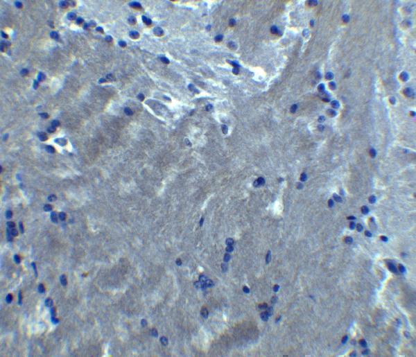 a02904 s1pr2 primary antibodies ihc testing 2