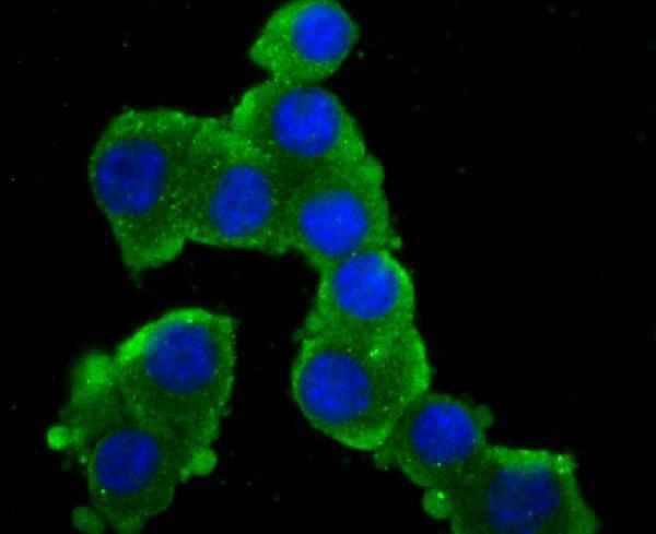 ICC staining GluR2 in N2A cells (green)