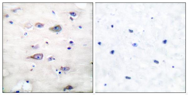 Immunohistochemistry analysis of paraffin-embedded human brain, using GluR2 (Phospho-Ser880) Antibody