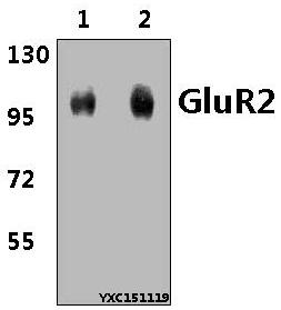 Western blot (WB) analysis of GluR2 (Y873) polyclonal antibody at 1:500 dillution
Lane1:The Brain tissue lysate of Rat(40μg)
Lane2:The Brain tissue lysate of Mouse(40μg)