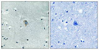 Immunohistochemical analysis of paraffin-embedded Human brain