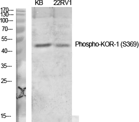Western blot analysis of various cells using Phospho-KOR-1 (S369) Polyclonal Antibody diluted at 1:1000
                
