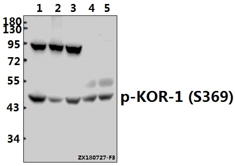 Western blot (WB) analysis of p-KOR-1 (S369) pAb at 1:500 dilution
Lane1:U-87MG whole cell lysate(40ug)
Lane2:PC3 whole cell lysate(40ug)
Lane3:HepG2 whole cell lysate(40ug)
Lane4:The Brain tissue lysate of Mouse(40ug)
Lane5:The Brain tissue lysate of Rat(40ug)