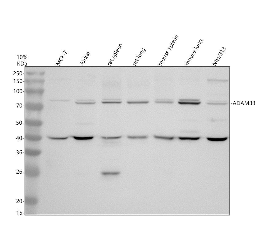 Western blot analysis of ADAM33 using anti-ADAM33 antibody (A02907-2)