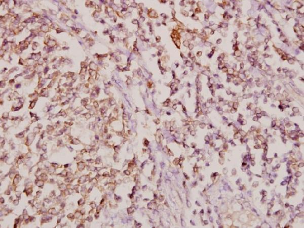 a02909 1 col11a1 primary antiboties ihc testing 2