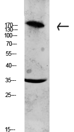 a02909 2 col11a1 primary antibodyes wb testing 1