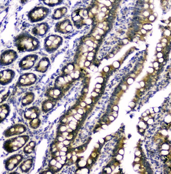  IHC analysis of RAB6A using anti-RAB6A antibody (A02911-1)