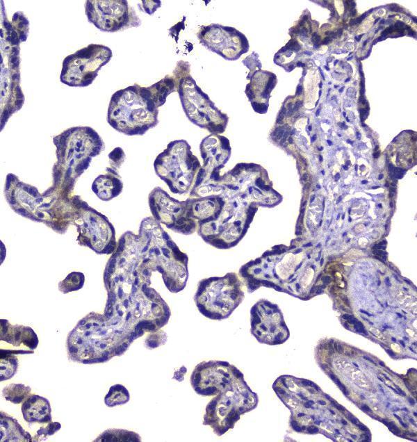  IHC analysis of RAB6A using anti-RAB6A antibody (A02911-1)