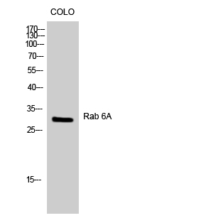 Western Blot analysis of COLO cells using Rab 6A Polyclonal Antibody diluted at 1:1000