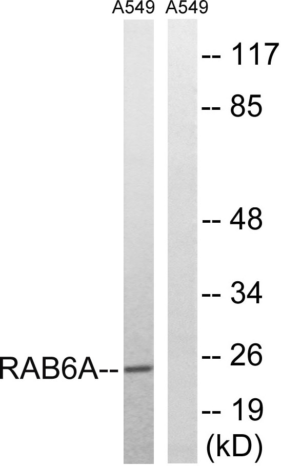 Western blot analysis of lysates from A549 cells, using RAB6A Antibody
