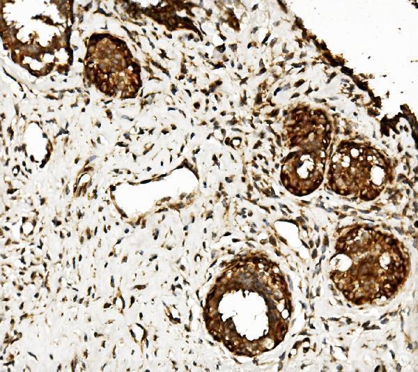 a02912 2 clpb primary antibodies ihc testing 2