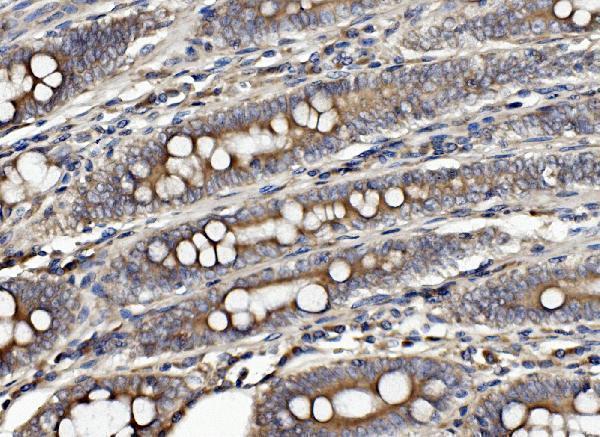 a02912 2 clpb primary antibodies ihc testing 3