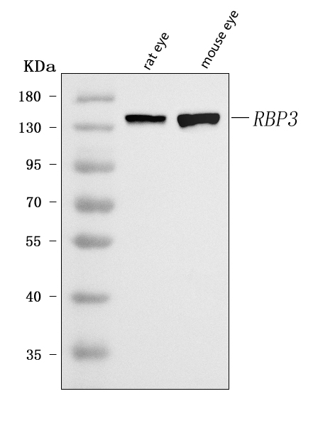  Western blot analysis of IRBP/RBP3 using anti-IRBP/RBP3 antibody (A02913-1)