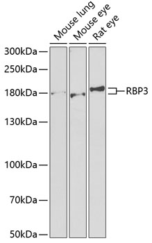 Western blot analysis of extracts of various cell lines, using RBP3 antibody  at 1:1000 dilution