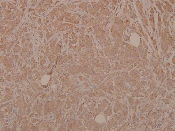 a02916s189 map2k3 primary antiboties ihc testing 2