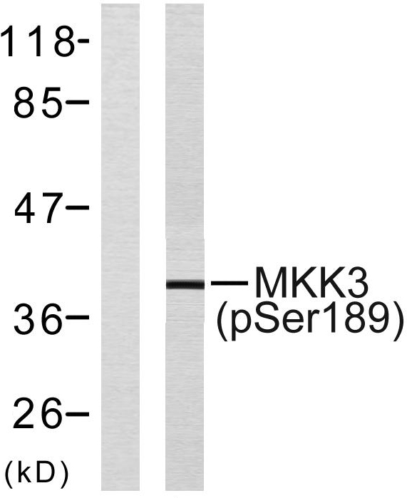 Western blot analysis of lysates from MDA-MB-435 cells, using MKK3 (Phospho-Ser189) Antibody