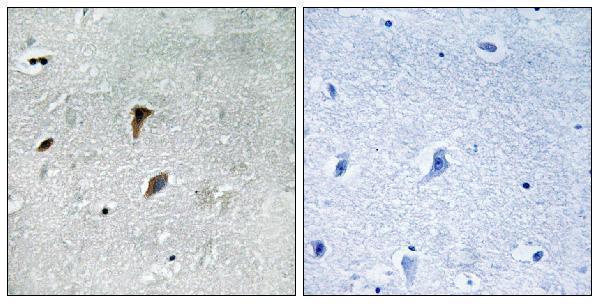 Immunohistochemistry analysis of paraffin-embedded human brain, using MAP2K3 (Phospho-Thr222) Antibody
