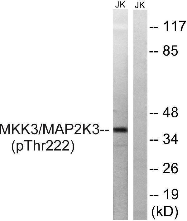 Western blot analysis of lysates from Jurkat cells treated with serum 20% 15', using MAP2K3 (Phospho-Thr222) Antibody