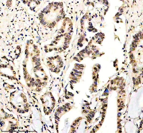 a02919 nrip1 primary antibodies ihc testing 1