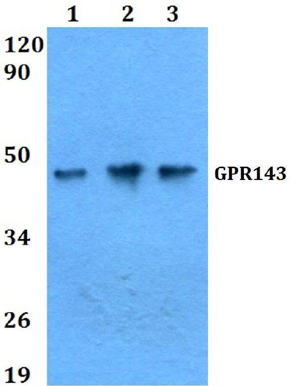 a02921 gpr143 primary antiboties wb testing 1