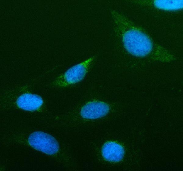 a02922 2 agr2 primary antibodies if testing 1