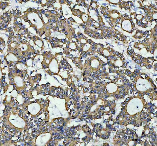 a02922 2 agr2 primary antibodies ihc testing 2