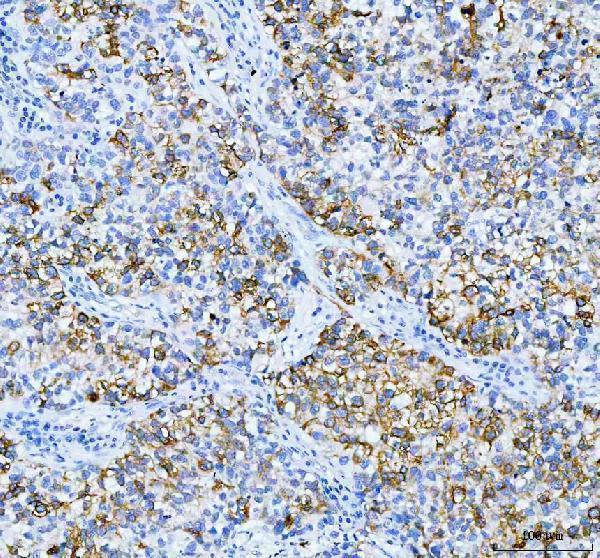 a02922 2 agr2 primary antibodies ihc testing 3