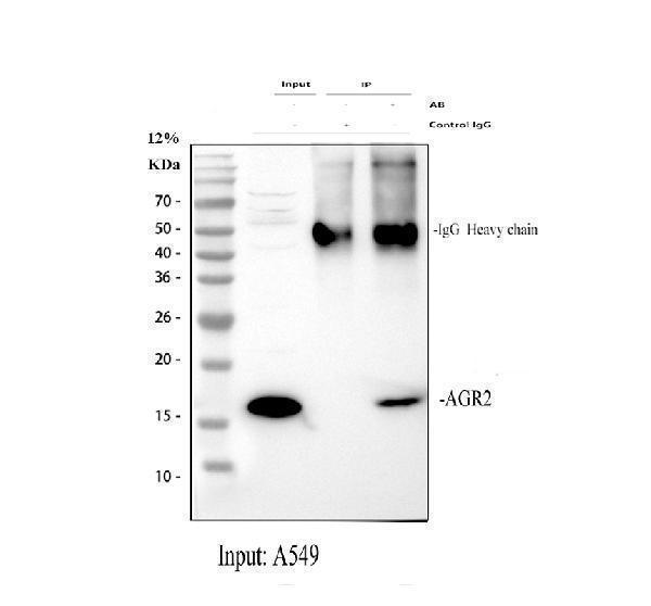 a02922 2 agr2 primary antibodies ip testing 1