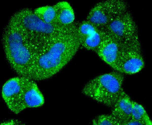 ICC staining AGR2 in Hela cells (green)