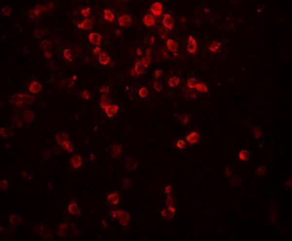 a02925 1 il9 primary antibodies ihc testing 5