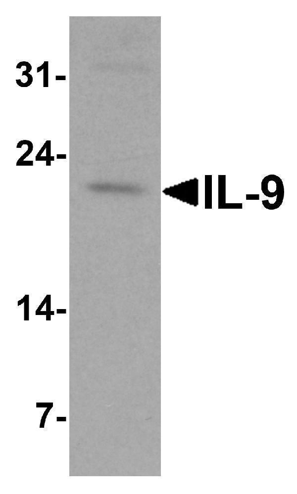 Western Blot Validation in Human Spleen  Tissue Lysate
Loading: 15 μg of lysates per lane