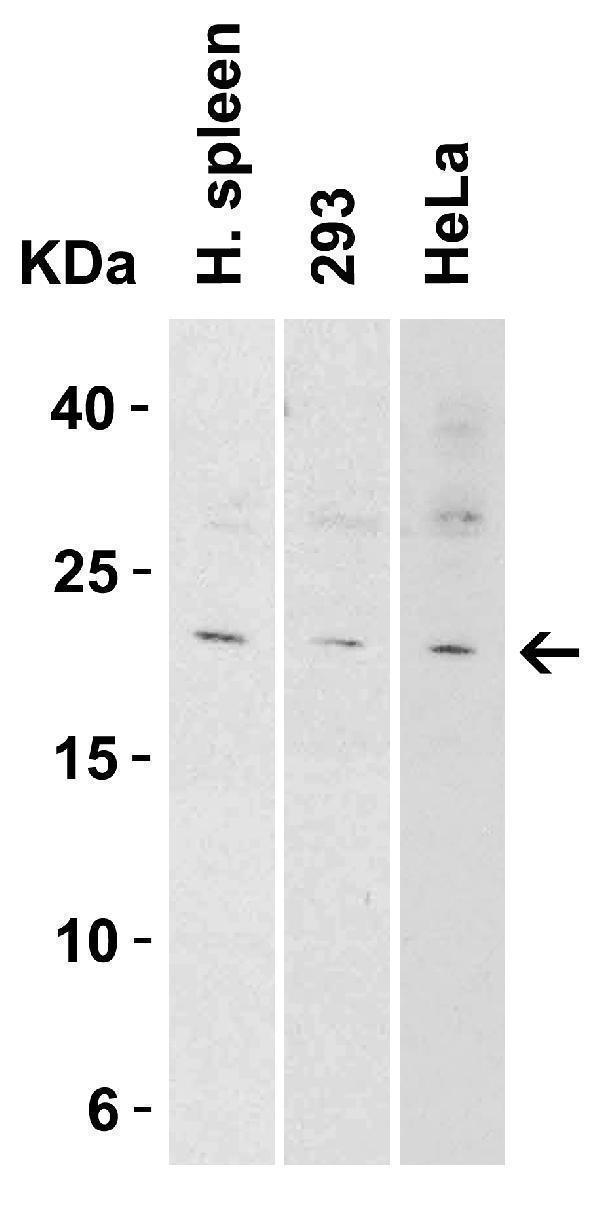 Western Blot Validation in Tissue and Cell Lines
Loading: 15 μg of lysates per lane