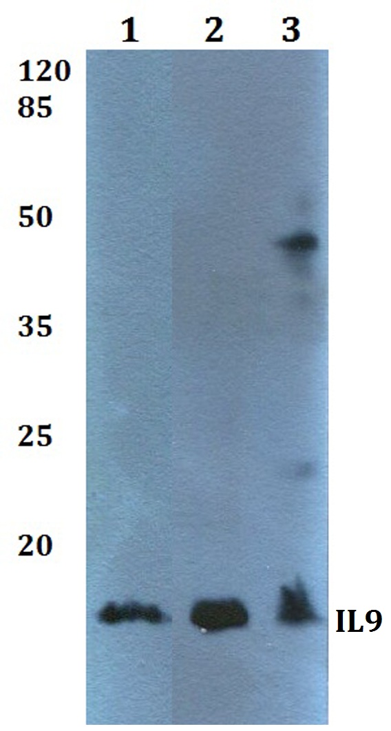 Western blot (WB) analysis of IL9 polyclonal antibody at 1:500 dilution
Lane1:HEK293T whole cell lysate
Lane2:Mouse heart tissue lysate
Lane3:Rat heart tissue lysate
