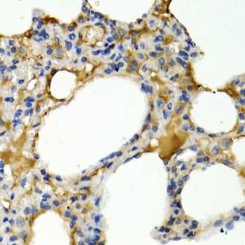 Immunohistochemistry of paraffin-embedded rat lung using IL9 antibody  at dilution of 1:200 