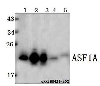 Western blot (WB) analysis of ASF1A polyclonal antibody at 1:500 dilution
Lane1:L02 whole cell lysate(40ug)
Lane2:A549 whole cell lysate(40ug)
Lane3:MCF-7 whole cell lysate(40ug)
Lane4:The lung tissue lysate of Mouse(40ug)
Lane5:The lung tissue lysate of Rat(40ug)