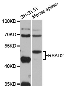 Western blot analysis of extracts of various cell lines, using RSAD2 antibody  at 1:1000 dilution